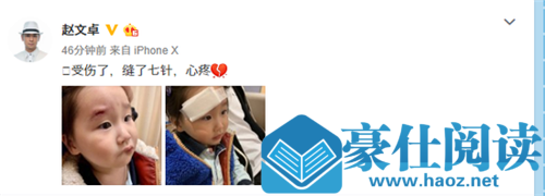 惊呆了!赵文卓女儿受伤 这到底是怎么回事？