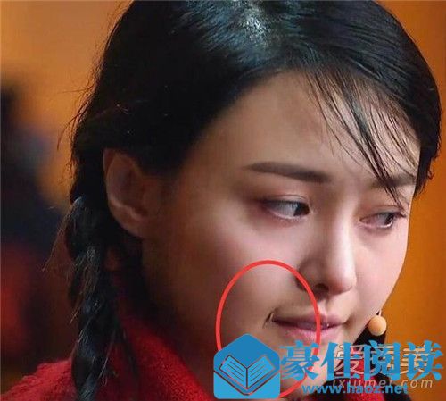 郑爽嘴角疤痕原因 郑爽嘴巴怎么有个疤痕