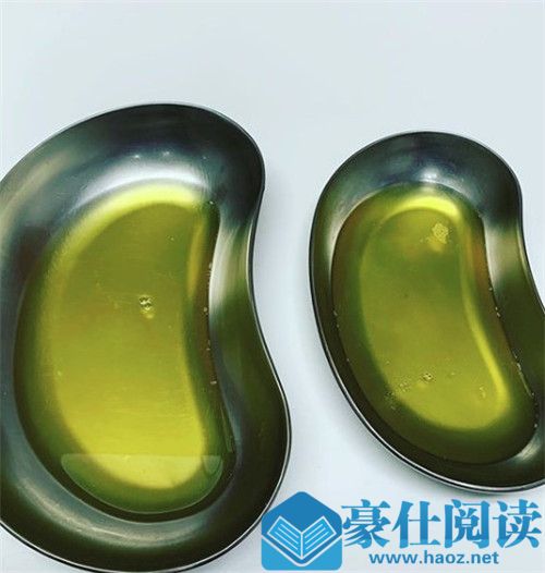 容祖儿膝盖严重水肿的原因 这到底是怎么回事