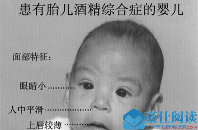 人工智能看脸识病
