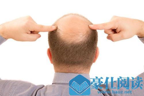 什么样的洗发水防脱发效果好?如何正确选择洗发水? 什么样的洗发水防脱发效果好?如何正确选择洗发水?