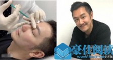 陈浩民承认整容是什么情况 陈浩民整容前后对比