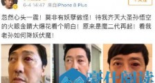 庾澄庆眼睛受伤什么情况 庾澄庆眼睛受伤什么原因