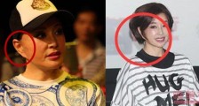 刘晓庆耳朵怎么了 刘晓庆耳朵太吓人了吧