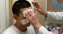 吴磊拍马戏脸部被炸伤 坚持拍完戏再上医院就诊