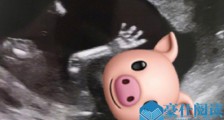 胡杏儿宣布二胎 胡杏儿晒二胎B超照怀孕几个月了呢?