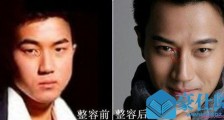 刘恺威整容真的吗 刘恺威整容前后照片对比差异大认不出【最新】