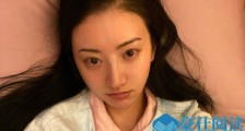 景甜晒生病卧床照 眼里尽是红血丝一下生4病令人心疼
