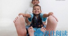 在世的人中最大的脚 委内瑞拉的20岁小伙右脚长40.1厘米