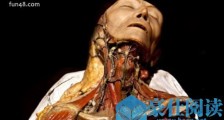 世界上最恐怖的博物馆 存放畸形人遗体最多的马特博物馆