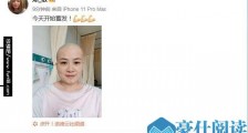 岳云鹏老婆回应生病剃光头怎么回事 岳云鹏老婆个人资料照片