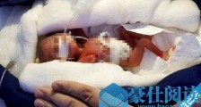 世界上最小的婴儿,体重仅400克像一块巧克力