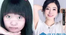 冯提莫告整形医院原因揭秘 冯提莫有没有整容高中素颜照曝光判若两人