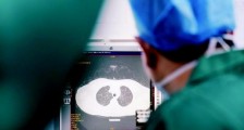 如何更精准地保卫我们的肺？肺癌发病人群呈“两头翘”的趋势 中国肺癌防治观察