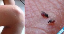 世界上最小的蚊子 墨蚊体长只有1