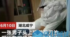 青年头插菜刀在医院等候治疗!湖北一青年头插菜刀等治疗 警方称正在调查
