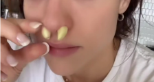 把大蒜塞进耳朵鼻孔有奇效,美国大蒜偏方有多胡逼?