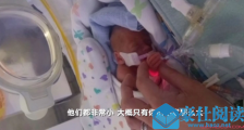 英最小双胞胎生还 详细经过大起底太不可思议了