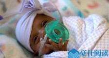 最小存活婴儿出院具体啥情况 最小存活婴儿Saybie出院始末