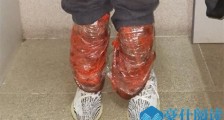 小腿绑6只鸡入境 因步姿异样被查现场画面令人瞠目