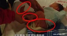 孩子出生有3条腿怎么回事 宝妈产检一次不落却没查出是为何【图】
