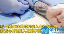美女子将车钥匙植入手臂 分享植入车钥匙芯片全程引围观