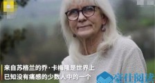 71岁奶奶天生无痛感 多次手术中不用麻醉令人瞠目结舌