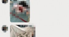 鄂尔多斯中心医院医生汤萌简历照片 被病人持刀捅伤